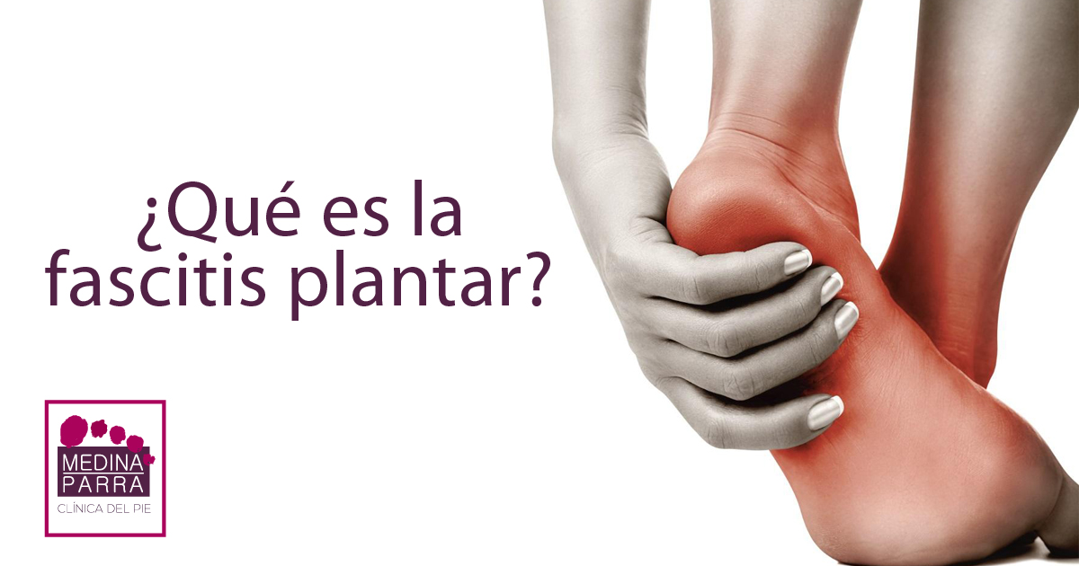 fascitis plantar